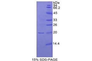 SDS-PAGE analysis of Rat Interferon beta Protein. (IFNB1 Protéine)