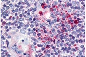 anti-Ubiquitin Specific Peptidase 4 (USP4) (N-Term) antibody