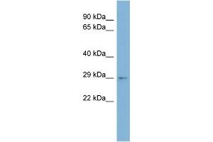 WB Suggested Anti-ARV1 Antibody Titration:  0. (ARV1 anticorps  (Middle Region))