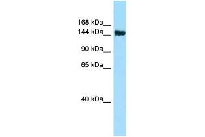 WB Suggested Anti-CD109 Antibody Titration: 1. (CD109 anticorps  (Middle Region))