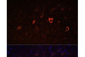 Immunofluorescence analysis of Mouse brain using KAL1 Polyclonal Antibody at dilution of 1:100.