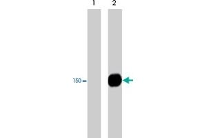 Western blot analysis of PLCG1 immunoprecipitates from human Jurkat cells untreated (lane 1) or treated with pervanadate (1 mM) for 30 min (lane 2).