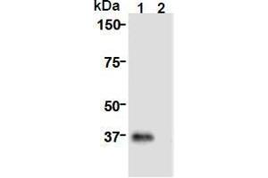 Western Blotting (WB) image for anti-Cell Division Cycle Associated 8 (CDCA8) (AA 1-280), (N-Term) antibody (ABIN1449290) (CDCA8 anticorps  (N-Term))