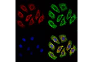 SEC61A Antibody staining Hela cells by IF/ICC. (SEC61A1 anticorps  (C-Term))