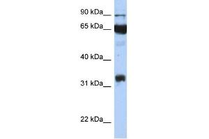 WB Suggested Anti-PTGS1 Antibody Titration:  0. (PTGS1 anticorps  (Middle Region))