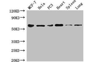 Western Blot Positive WB detected in: MCF-7 whole cell lysate, Hela whole cell lysate, PC-3 whole cell lysate, Mouse heart tissue, Mouse spleen tissue, Mouse lung tissue All lanes: TROVE2 antibody at 3 μg/mL Secondary Goat polyclonal to rabbit IgG at 1/50000 dilution Predicted band size: 61, 24, 59, 60 kDa Observed band size: 61 kDa (TROVE2 anticorps  (AA 3-535))
