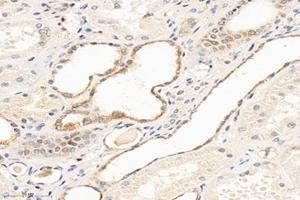 Immunohistochemistry analysis of paraffin-embedded human kidney using,MTND1 (ABIN7074658) at dilution of 1: 1000