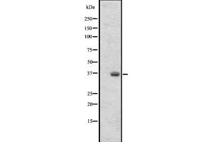 Western blot analysis of OR2T27 expression in 293 cell line lysates ,The lane on the left is treated with the antigen-specific peptide. (OR2T27 anticorps  (Internal Region))