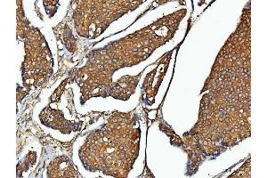 IHC analysis of EEF2 using anti-EEF2 antibody (ABIN7599561). (EEF2 anticorps  (AA 1-858))