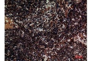 Immunohistochemistry (IHC) analysis of paraffin-embedded Human Lymph, antibody was diluted at 1:100.