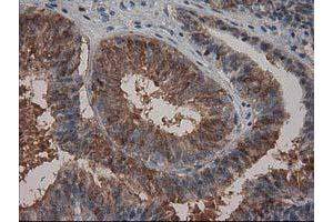 Immunohistochemistry (IHC) image for anti-Hydroxyprostaglandin Dehydrogenase 15-(NAD) (HPGD) antibody (ABIN1496362) (HPGD anticorps)