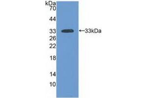 Detection of Recombinant LAMa3, Human using Polyclonal Antibody to Laminin Alpha 3 (LAMa3) (LAMA3 anticorps  (AA 47-296))