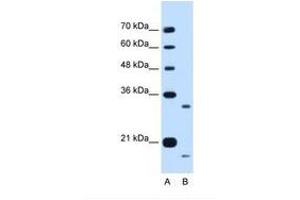 Image no. 1 for anti-Cell Cycle Progression 1 (CCPG1) (AA 301-350) antibody (ABIN6738251) (CCPG1 anticorps  (AA 301-350))
