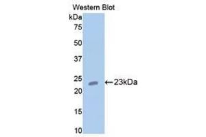 Western Blotting (WB) image for anti-Cartilage Oligomeric Matrix Protein (COMP) (AA 235-423) antibody (ABIN1858467) (COMP anticorps  (AA 235-423))