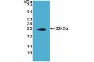 Western blot analysis of recombinant Human DKC. (DKC1 anticorps  (AA 298-465))