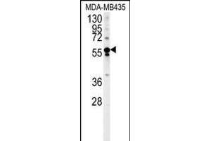 ARHGEF3 Antibody (Center) (ABIN652003 and ABIN2840492) western blot analysis in MDA-M cell line lysates (35 μg/lane). (ARHGEF3 anticorps  (AA 211-240))