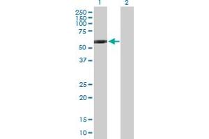 Western Blot analysis of GPI expression in transfected 293T cell line by GPI MaxPab polyclonal antibody.
