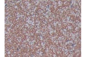 Detection of ACE2 in Rat Spinal cord Tissue using Polyclonal Antibody to Angiotensin I Converting Enzyme 2 (ACE2)