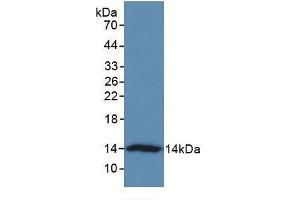 anti-V-Set Domain Containing T Cell Activation Inhibitor 1 (VTCN1) (AA 34-147) antibody