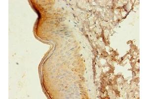 Immunohistochemistry of paraffin-embedded human skin tissue using ABIN7145104 at dilution of 1:100 (ATG16L1 anticorps  (AA 1-607))