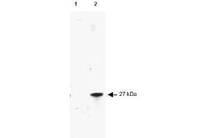 Image no. 1 for anti-Red Fluorescent Protein (RFP) antibody (FITC) (ABIN401227) (RFP anticorps  (FITC))