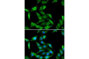 Immunofluorescence analysis of U2OS cells using GAMT antibody.