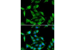 Immunofluorescence analysis of U2OS cells using GAMT antibody. (GAMT anticorps  (AA 1-236))