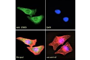 ABIN184593 Immunofluorescence analysis of paraformaldehyde fixed HeLa cells, permeabilized with 0.