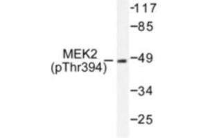 Image no. 1 for anti-Mitogen-Activated Protein Kinase Kinase 2 (MAP2K2) (pThr394) antibody (ABIN318069)