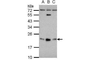WB Image Sample (30 ug of whole cell lysate) A: NT2D1 B: PC-3 C: U87-MG 12% SDS PAGE antibody diluted at 1:500 (GLIPR1L1 anticorps  (Center))