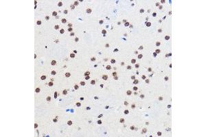 Immunohistochemistry of paraffin-embedded Mouse brain using GTF3C3 Rabbit pAb (ABIN7267374) at dilution of 1:100 (40x lens).