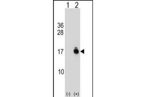 Western blot analysis of ACYP1 (arrow) using rabbit polyclonal ACYP1 Antibody (C-term) (ABIN1537423 and ABIN2849002).