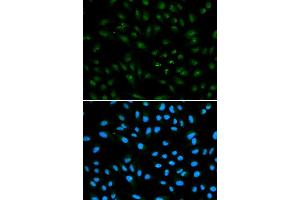 Immunofluorescence analysis of A549 cell using AR antibody. (Androgen Receptor anticorps)