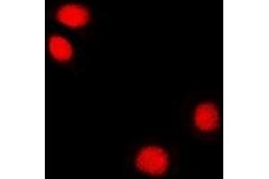 Immunofluorescent analysis of Reptin 52 staining in U2OS cells. (RUVBL2 anticorps)