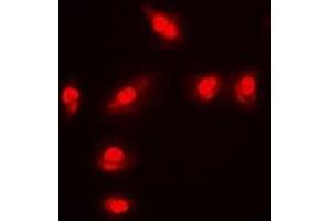 Immunofluorescent analysis of FOXO1 (pS256) staining in MCF7 cells. (FOXO1 anticorps  (pSer256))