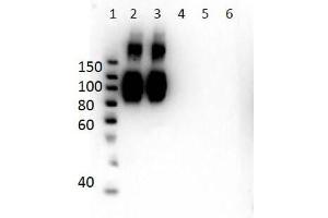 Western Blot of Mouse Anti-Hemoglobin A (beta chain) Antibody.