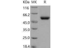 Western Blotting (WB) image for Carboxypeptidase M (CPM) (Active) protein (His tag) (ABIN7320083)