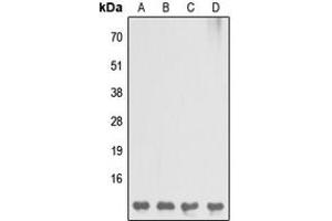 Western blot analysis of DBI expression in MCF7 (A), Raw264. (Diazepam Binding Inhibitor anticorps  (C-Term))