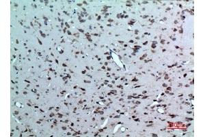 Immunohistochemical analysis of paraffin-embedded rat-brain, antibody was diluted at 1:100.
