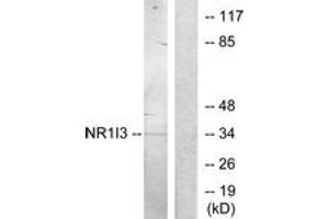 Western blot analysis of extracts from Jurkat cells, treated with serum 20% 15', using NR1I3 Antibody. (NR1I3 anticorps  (AA 71-120))