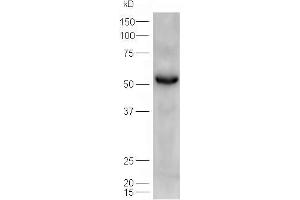 Lane 1: mouse heart  probed with Rabbit Anti-ATGL/Adipose Triglyceride Lipase Polyclonal Antibody, Unconjugated (ABIN704756) at 1:300 overnight at 4 °C. (PNPLA2 anticorps  (AA 401-504))
