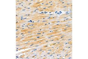 Immunohistochemistry of paraffin embedded rat heart using SCN4b (ABIN7075646) at dilution of 1:2000 (300x lens) (SCN4B anticorps)