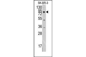 Image no. 1 for anti-Discoidin Domain Receptor tyrosine Kinase 1 (DDR1) antibody (ABIN359899) (DDR1 anticorps)