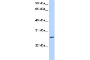 Western Blotting (WB) image for anti-Zinc Finger Protein 664 (ZNF664) antibody (ABIN2463457) (ZNF664 anticorps)