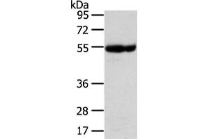 Western Blotting (WB) image for anti-Ubiquitin Associated Protein 1 (UBAP1) antibody (ABIN5961309) (UBAP1 anticorps)