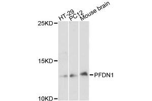 Western blot analysis of extracts of various cell lines, using PFDN1 antibody (ABIN5996513) at 1:3000 dilution. (PFDN1 anticorps)