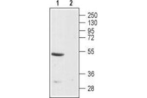Western blot analysis of rat brain membranes: - 1.
