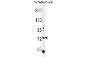 Western Blotting (WB) image for anti-Leucine-Rich Repeat and WD Repeat-Containing Protein 1 (LRWD1) antibody (ABIN2996388) (LRWD1 anticorps)