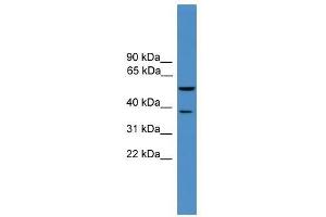 Bace1 antibody used at 0. (BACE1 anticorps  (Middle Region))