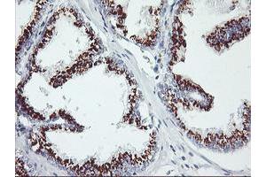 Image no. 1 for anti-Golgi Membrane Protein 1 (GOLM1) antibody (ABIN1498497) (GOLM1 anticorps)